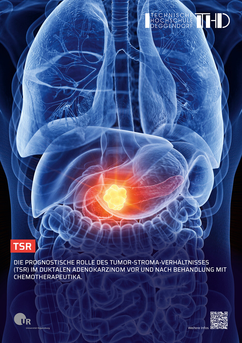 Featurette Image